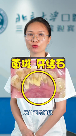 一刷牙就出血？別慌，看看醫(yī)生怎么說